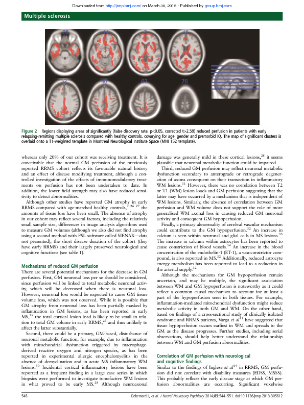Download Reduced grey matter perfusion without volume loss in early relapsing-remitting multiple sclerosis.