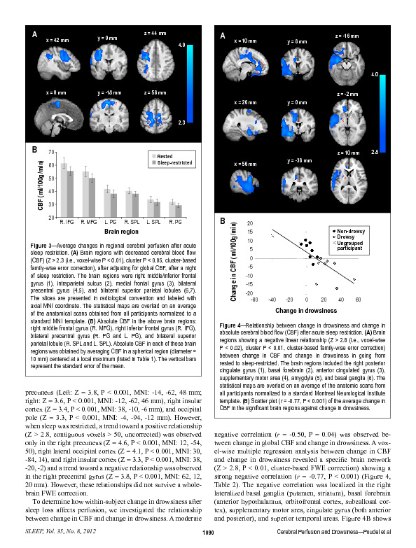 Download Cerebral perfusion differences between drowsy and non-drowsy individuals following acute sleep restriction.