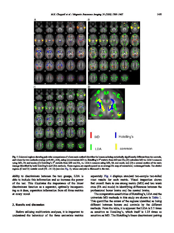 Download Multivariate analysis of diffusion tensor imaging data improves the detection of microstructural damage in young professional boxers.