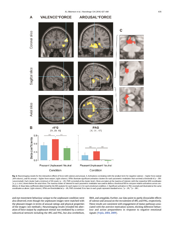Download Negative emotions facilitate isometric force through activation of prefrontal cortex and periaqueductal gray.