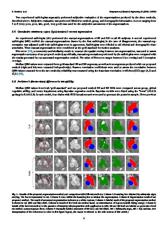 Download Automated segmentation of substantia nigra and red nucleus using quantitative susceptibility mapping images: application to Parkinson’s disease.